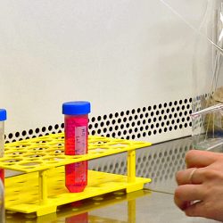 Lire la suite à propos de l’article MICAH · Microenvironnement et cancers hématologiques