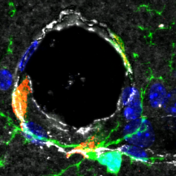 Lire la suite à propos de l’article Un institut de recherche dédié aux interactions Sang et Cerveau