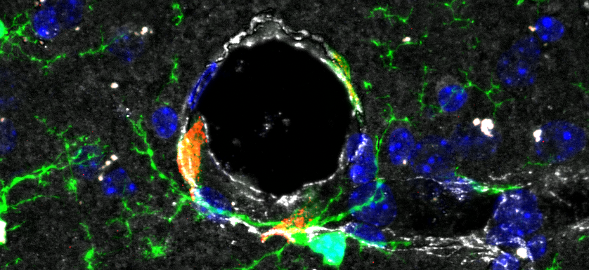 You are currently viewing Un institut de recherche dédié aux interactions Sang et Cerveau