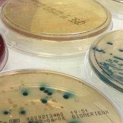 Lire la suite à propos de l’article UMRS 1311 – Dynamique Microbienne associée aux Infections Urinaires et Respiratoires · DYNAMICURE